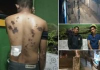 Penjaga Malam Perumahan di Talang Jambe Disiram Air Keras, Satu Pelaku Diduga Pria Idaman Janda